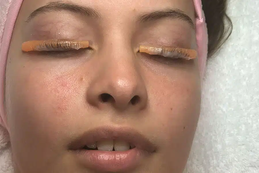 Eyelash Eyebrow Treatment Sydney