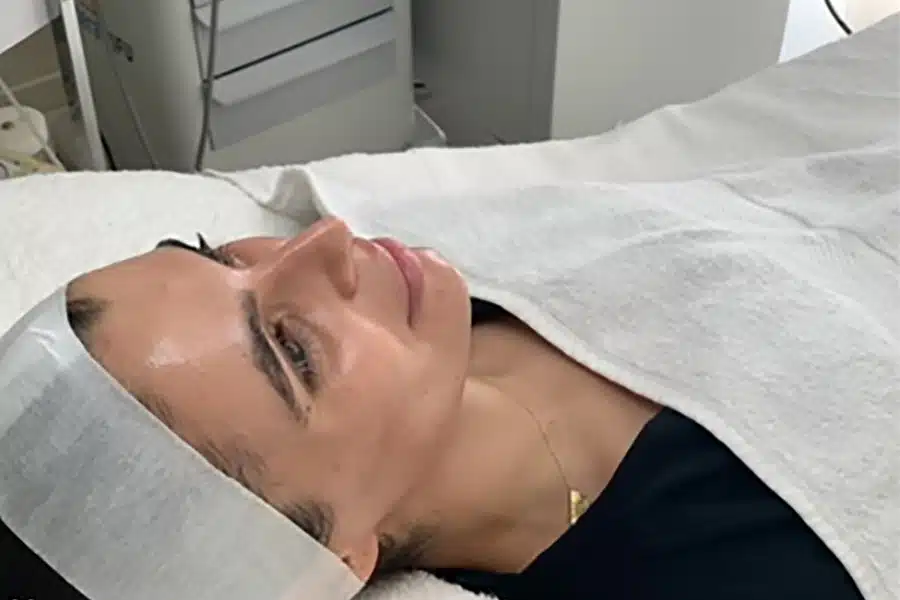 Stem Cell Facial Treatment Sydney